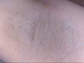 300人の腋 2　サンプル画像15